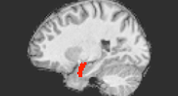 Image of brain